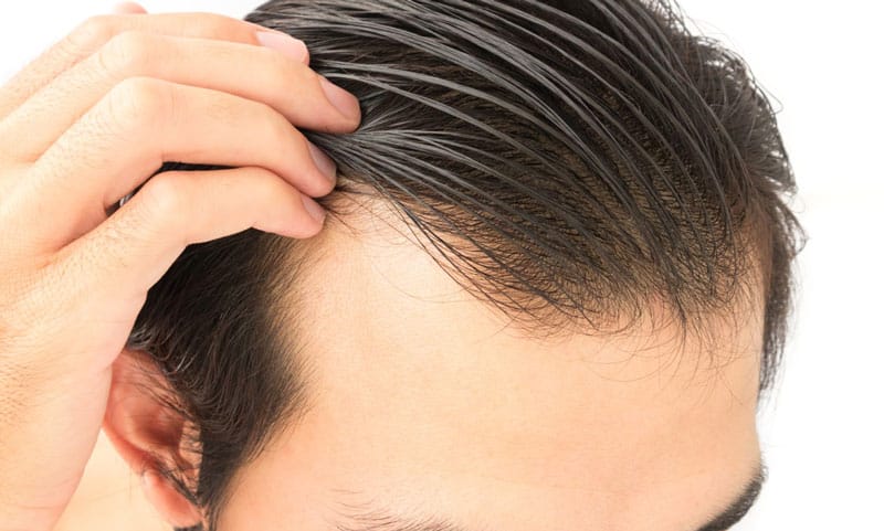 PRP plasma therapy for the prevention of hair loss - Plastic Surgery Center